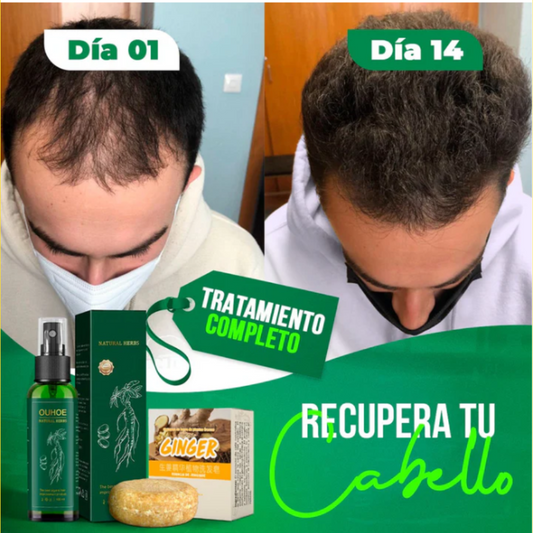 OUHOE-SPRAY PARA CAIDA DE CABELLO 100% (ORIGINAL)